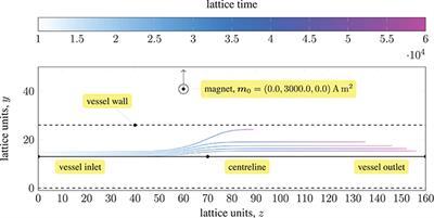 Modeling Patient-Specific Magnetic Drug Targeting Within the Intracranial Vasculature